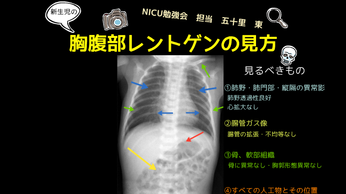 胸腹部レントゲンの見方 By Azuma Ikari