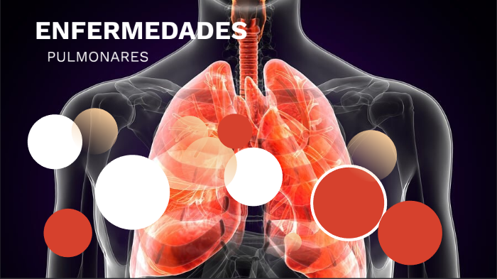 Enfermedades Pulmonares by Alex Moyano on Prezi Next